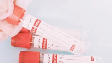 Recogida de sangre de vacío desechables tubo normal con CE e ISO